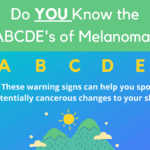 The ABCDE’s of Melanoma
