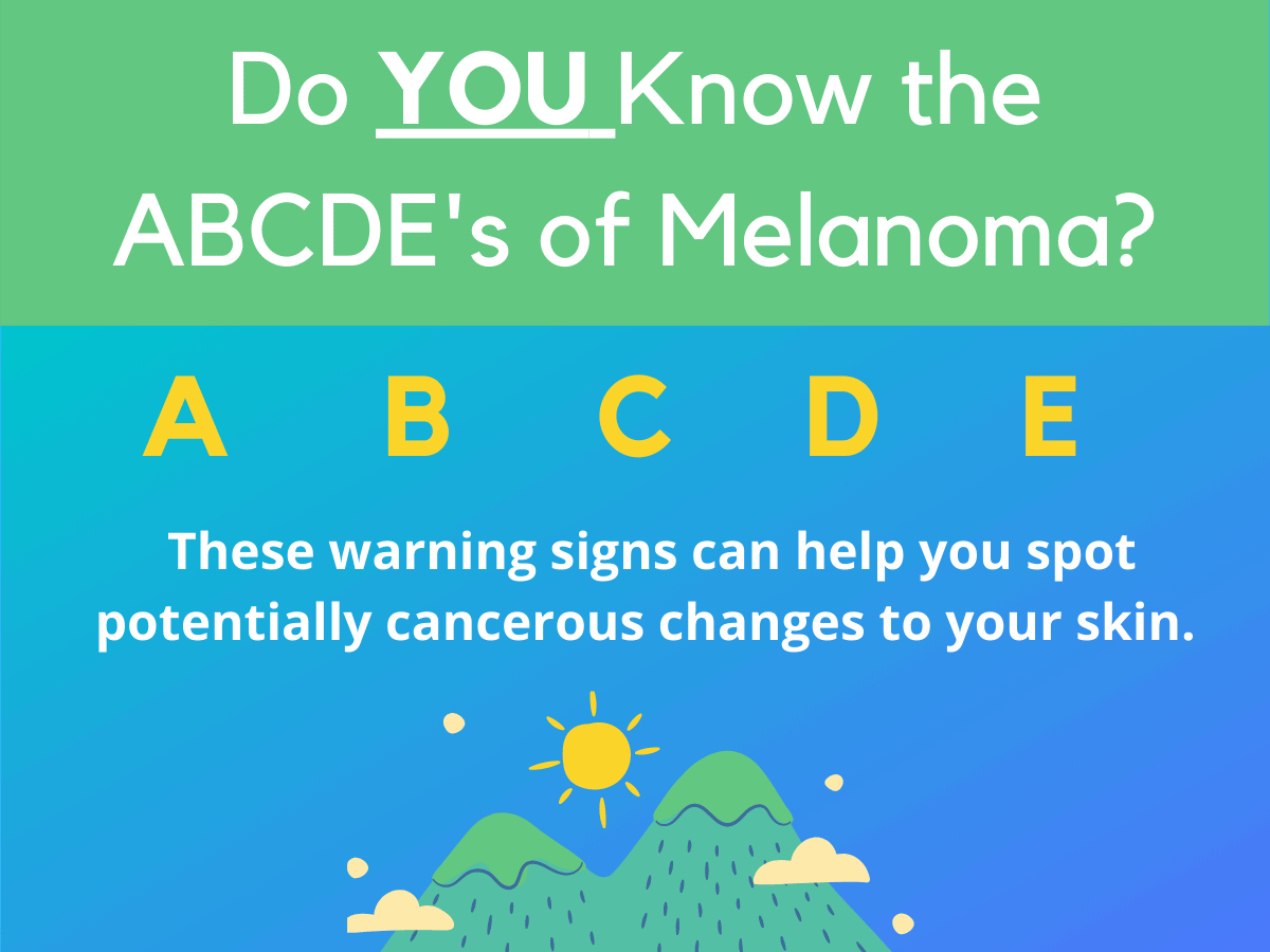 ABCDEs of Melanoma