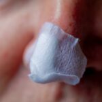 Can You Speed Up Healing After Mohs?